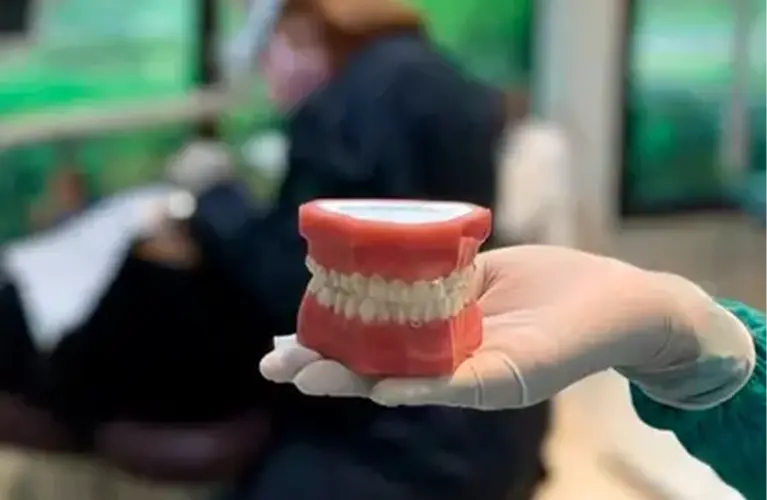 Tratamento ortodôntico para alinhamento dos dentes e correção da mordida.